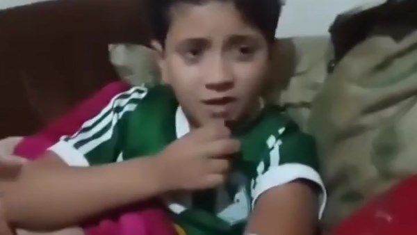شقيقة جارة الطفل آدم: الكلب عقر جزءا من إيده… وهجمات الكلاب بقت جماعات في بورسعيد