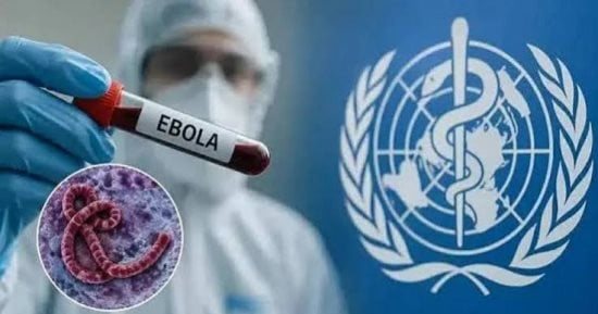 الصحة العالمية: إصابة هولندى بفيروس إيبولا والكونغو تسجل 8728 حالة